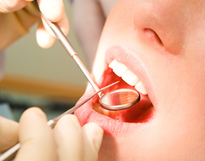 An Emergency Dentist in Chantilly Can Get You Timely Dental Care