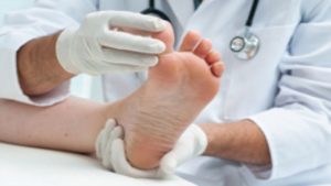 Foot Care in Plainfield: Tips to Prevent Hammertoe from Developing