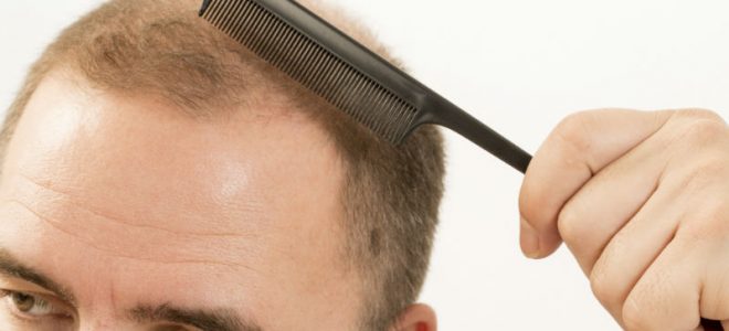 Follicular Unit Extraction: What Is Right for You?