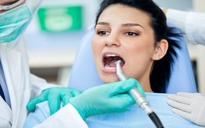 A Million Dollar Smile with Veneers in Calgary AB