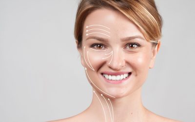 What to Expect From a PDO Threads Orlando FL Non Surgical Facelift Procedure