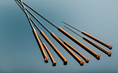 Managing Stress Naturally with Acupuncture For Anxiety in Berkeley, CA: Holistic Approaches