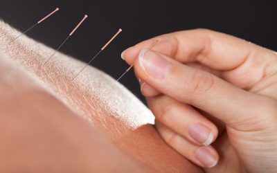 Boost Natural Conception with Acupuncture Fertility Treatment Stratford CT Success Stories